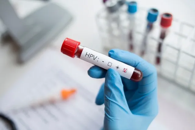 Zdravniki opozarjajo na strm porast raka zaradi virusa HPV pri moških