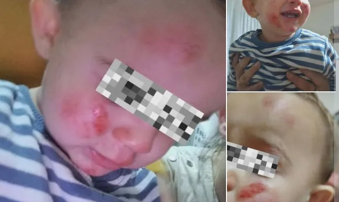 Кучиња нападнале мајка со малолетни деца во кичевско, едното дете има повреди по лицето!